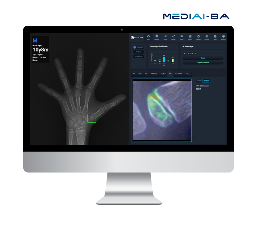 MEDIAI-BA